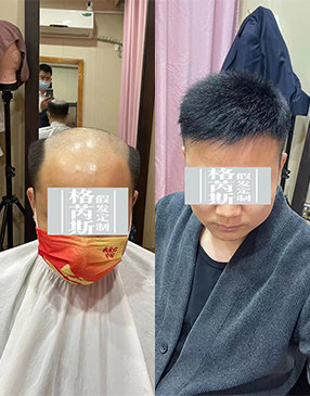 制作好后，根據(jù)您的頭型量身剪裁，設(shè)計(jì)您喜歡的發(fā)型